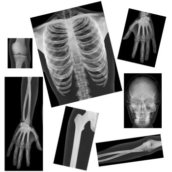 True-to-Life Human X-Rays